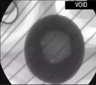 X-RAY檢測 X-RAY檢測